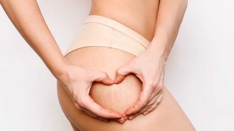 Stomacul si soldurile femeii